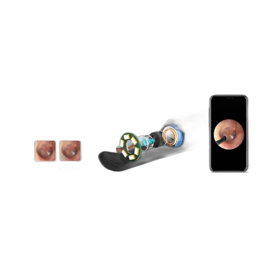 Xlife Smart Wireless Ear Otoscope